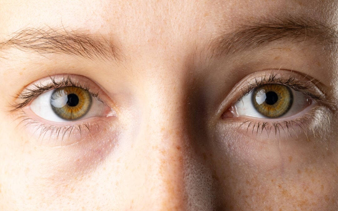 Sleep Apnea and Glaucoma: Understanding the Connection